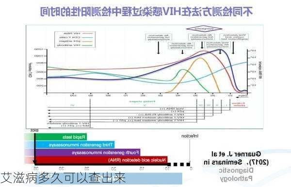 艾滋病多久可以查出来-第2张图片-欧景旅游网