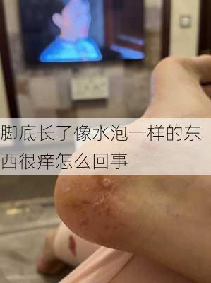 脚底长了像水泡一样的东西很痒怎么回事